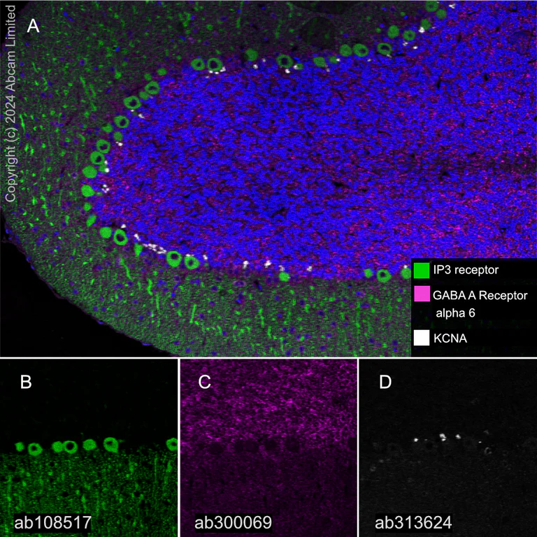 Multiplex immunohistochemistry - Anti-IP3 receptor antibody [EPR4537] (AB108517)