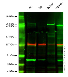 Western blot - Anti-IP3 receptor antibody [EPR4537] (AB108517)