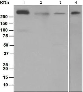 Western blot - Anti-IP3 receptor antibody [EPR4537] (AB108517)