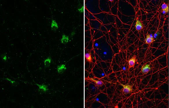Immunohistochemistry (Formalin/PFA-fixed paraffin-embedded sections) - Anti-IP3 Receptor I antibody [HL1541] (AB308165)