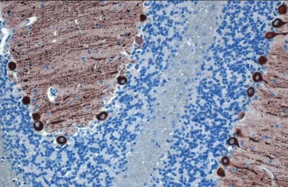 Immunohistochemistry (Formalin/PFA-fixed paraffin-embedded sections) - Anti-IP3 Receptor I antibody [HL1541] (AB308165)