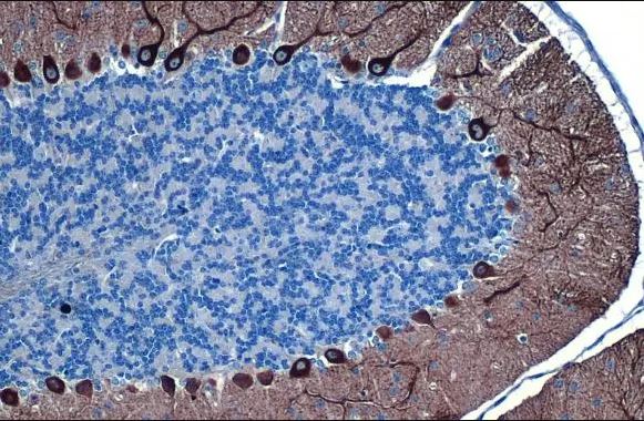 Immunohistochemistry (Formalin/PFA-fixed paraffin-embedded sections) - Anti-IP3 Receptor I antibody [HL1541] (AB308165)