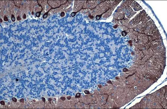 Immunohistochemistry (Formalin/PFA-fixed paraffin-embedded sections) - Anti-IP3 Receptor I antibody [HL1541] (AB308165)