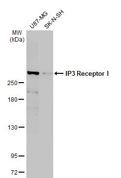IP3 Receptor I抗体[HL1541] (ab308165)| Abcam中文官网