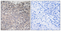Immunohistochemistry (Formalin/PFA-fixed paraffin-embedded sections) - Anti-IP3 receptor (phospho S1598) antibody (AB111615)