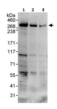 Western blot - Anti-IP3R1 antibody (AB264280), expandable thumbnail