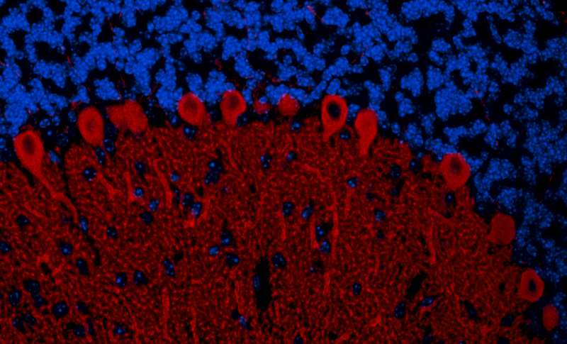 Immunohistochemistry (Formalin/PFA-fixed paraffin-embedded sections) - Anti-IP3R1 antibody (AB264281), expandable thumbnail
