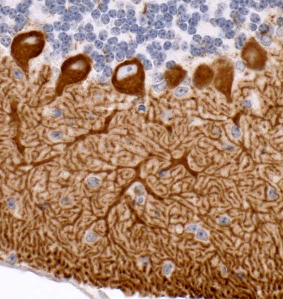Immunohistochemistry (Formalin/PFA-fixed paraffin-embedded sections) - Anti-IP3R1 antibody (AB264281), expandable thumbnail