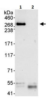 Immunoprecipitation - Anti-IP3R1 antibody (AB264281), expandable thumbnail