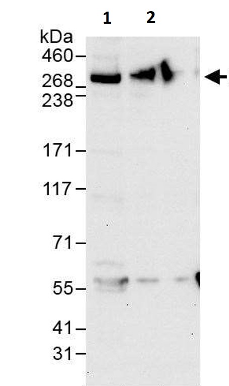 Western blot - Anti-IP3R1 antibody (AB264281), expandable thumbnail