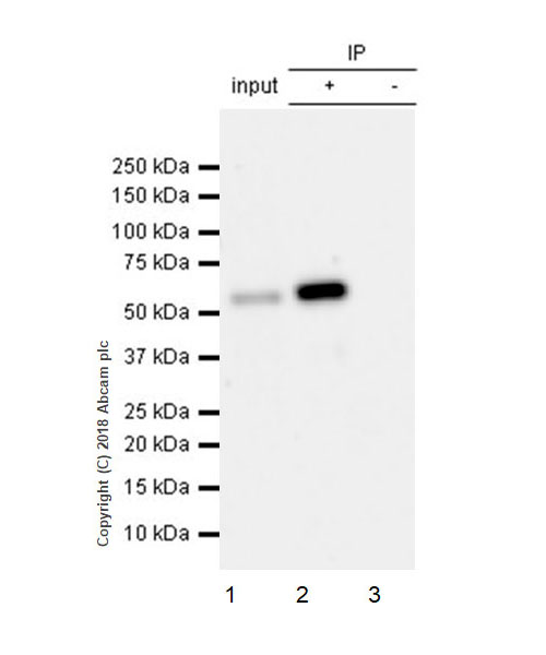 Immunoprecipitation - Anti-IP6K1 (phospho S118 + S121) antibody [EPR19852] (AB214816), expandable thumbnail