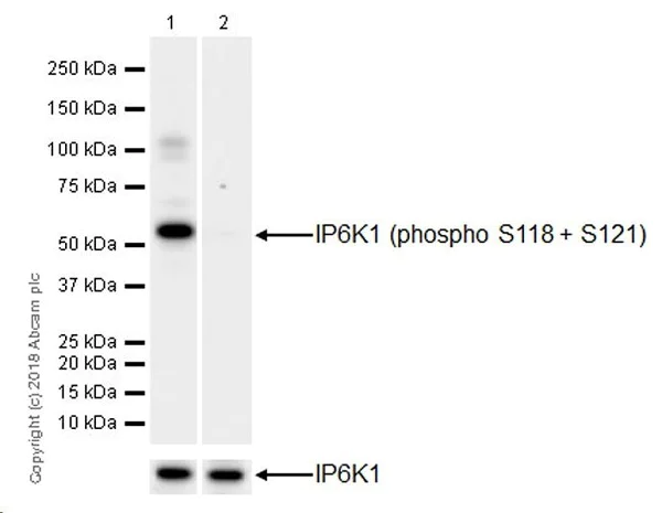 Western blot - Anti-IP6K1 (phospho S118 + S121) antibody [EPR19852] (AB214816)