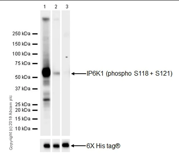 Western blot - Anti-IP6K1 (phospho S118 + S121) antibody [EPR19852] (AB214816)