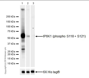 Western blot - Anti-IP6K1 (phospho S118 + S121) antibody [EPR19852] - BSA and Azide free (AB238170)