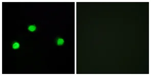 Immunocytochemistry/ Immunofluorescence - Anti-IP6K2 antibody (AB179921)
