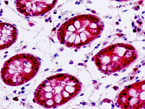 Immunohistochemistry (Formalin/PFA-fixed paraffin-embedded sections) - Anti-IP6K2 antibody (AB179921)
