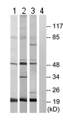 Western blot - Anti-IP6K2 antibody (AB179921)