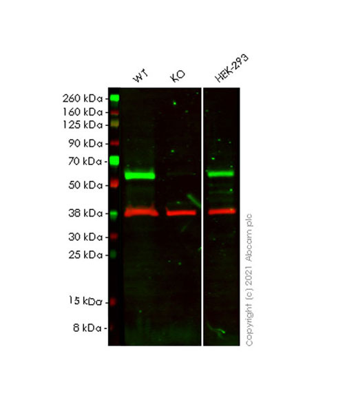 Western blot - Anti-IP6K2 antibody [EPR23538-12] (AB252414), expandable thumbnail