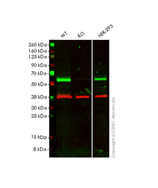 Western blot - Anti-IP6K2 antibody [EPR23538-12] - BSA and Azide free (AB284392)