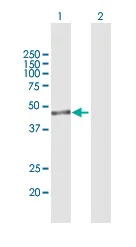 Western blot - Anti-IPMK antibody (AB169241)