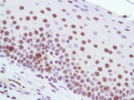 Immunohistochemistry (Formalin/PFA-fixed paraffin-embedded sections) - Anti-IPO 38 antibody [SPM515] (AB231428), expandable thumbnail