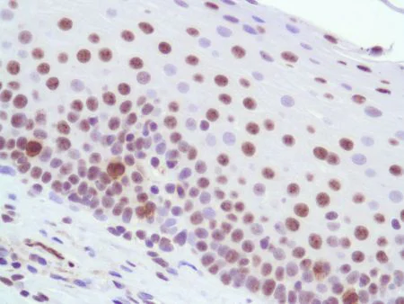 Immunohistochemistry (Formalin/PFA-fixed paraffin-embedded sections) - Anti-IPO 38 antibody [SPM515] (AB231428)