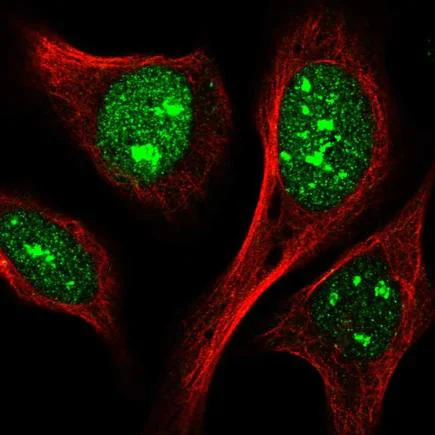 Immunocytochemistry/ Immunofluorescence - Anti-IPO11 antibody (AB221615)