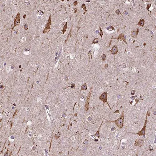 Immunohistochemistry (Formalin/PFA-fixed paraffin-embedded sections) - Anti-IPO11 antibody (AB221615)