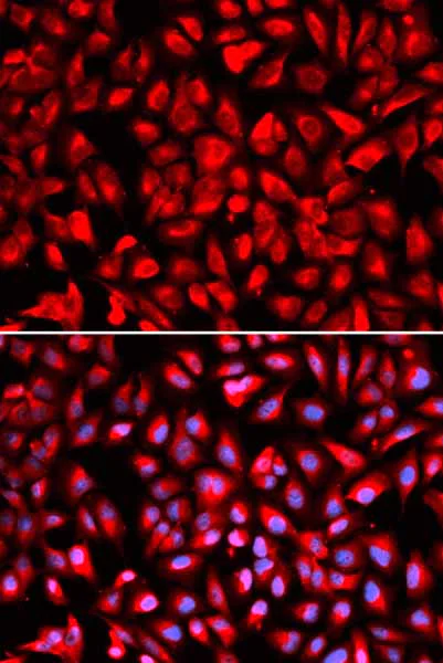 Immunocytochemistry/ Immunofluorescence - Anti-IPO5 antibody (AB187175)
