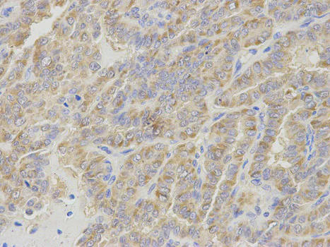 Immunohistochemistry (Formalin/PFA-fixed paraffin-embedded sections) - Anti-IPO5 antibody (AB187175)