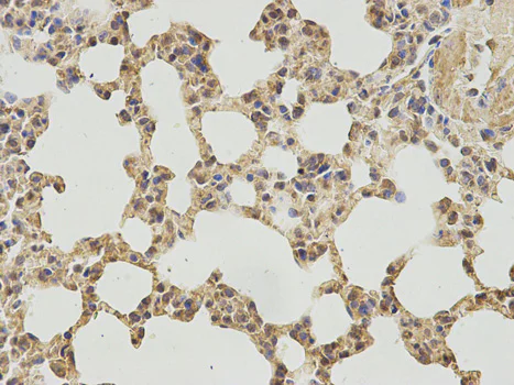 Immunohistochemistry (Formalin/PFA-fixed paraffin-embedded sections) - Anti-IPO5 antibody (AB187175)