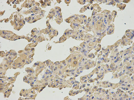 Immunohistochemistry (Formalin/PFA-fixed paraffin-embedded sections) - Anti-IPO5 antibody (AB187175)