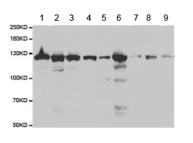 Western blot - Anti-IPO5 antibody (AB187175)