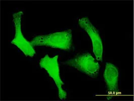 Immunocytochemistry/ Immunofluorescence - Anti-IPO5 antibody (AB88695)