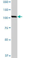 Western blot - Anti-IPO5 antibody (AB88695)