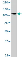Western blot - Anti-IPO5 antibody (AB88695)
