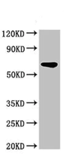 Western blot - Anti-IPP antibody (AB236772)