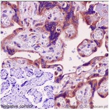 Immunohistochemistry (Formalin/PFA-fixed paraffin-embedded sections) - Anti-IPP antibody [EPR15575] (AB192266)