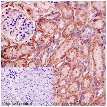Immunohistochemistry (Formalin/PFA-fixed paraffin-embedded sections) - Anti-IPP antibody [EPR15575] - BSA and Azide free (AB251133)