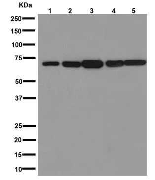 Western blot - Anti-IPP antibody [EPR15575] - BSA and Azide free (AB251133)