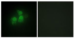 Immunocytochemistry/ Immunofluorescence - Anti-IPPK/IPK1 antibody (AB196781)
