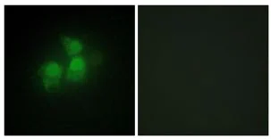 Immunocytochemistry/ Immunofluorescence - Anti-IPPK/IPK1 antibody (AB196781)