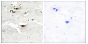 Immunohistochemistry (Formalin/PFA-fixed paraffin-embedded sections) - Anti-IPPK/IPK1 antibody (AB196781)