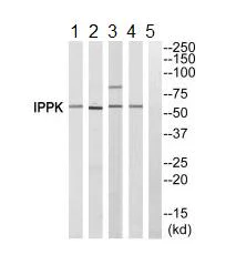 Western blot - Anti-IPPK/IPK1 antibody (AB196781)