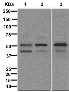 Western blot - Anti-IPT antibody [EPR12517] - BSA and Azide free (AB249810)