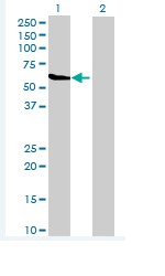 Western blot - Anti-IQ motif containing B1 antibody (AB69927)