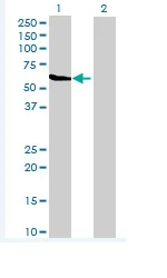 Western blot - Anti-IQ motif containing B1 antibody (AB69927)