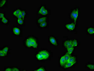 Immunocytochemistry/ Immunofluorescence - Anti-IQCG antibody (AB223041)