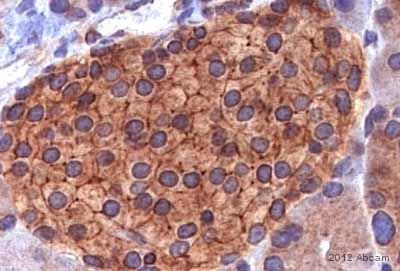 Immunohistochemistry (Formalin/PFA-fixed paraffin-embedded sections) - Anti-IQGAP1 antibody (AB86064)