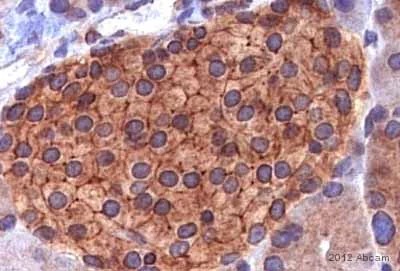 Immunohistochemistry (Formalin/PFA-fixed paraffin-embedded sections) - Anti-IQGAP1 antibody (AB86064)